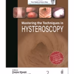 Mastering The Techniques In Hysteroscopy