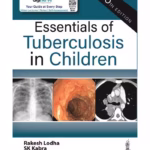 Essentials Of Tuberculosis In Children