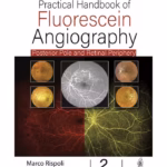 Practical Handbook Of Fluorescein Angiography: Posterior And Retinal Periphery