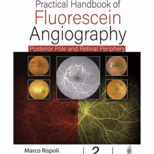 Practical Handbook Of Fluorescein Angiography: Posterior And Retinal Periphery