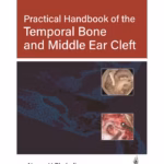 Practical Handbook Of The Temporal Bone And Middle Ear Cleft
