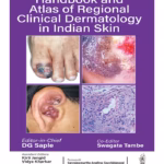 Handbook And Atlas Of Regional Clinical Dermatology In Indian Skin