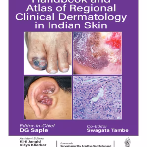 Handbook And Atlas Of Regional Clinical Dermatology In Indian Skin
