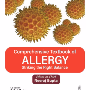 Comprehensive Textbook Of Allergy Striking The Right Balance