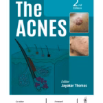 The Acnes