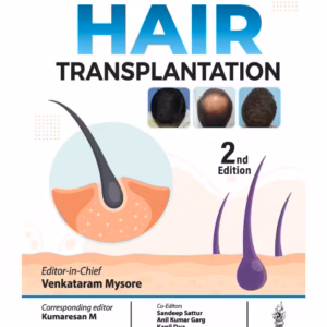 Hair Transplantation