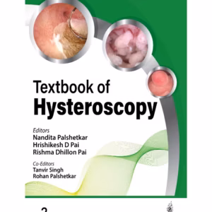 Textbook Of Hysteroscopy