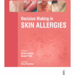 Decision Making In Skin Allergies