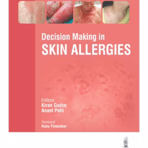 Decision Making In Skin Allergies