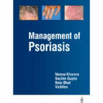 Management Of Psoriasis