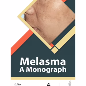 Melasma: A Monograph