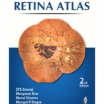 Retina Atlas