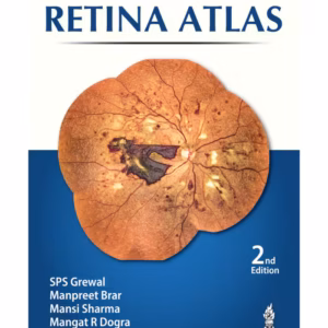 Retina Atlas
