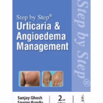Step By Step Urticaria And Angioedema Management