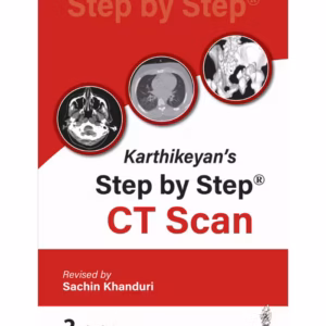 Karthikeyan'S Step By Step Ct Scan