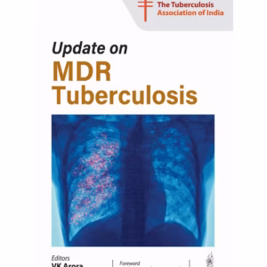 Update On Mdr Tuberculosis