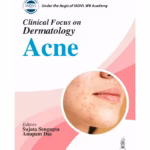 Clinical Focus On Dermatology Acne
