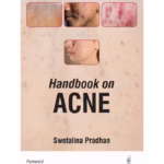 Handbook On Acne