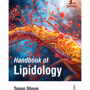 Handbook Of Lipidology