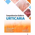 Comprehensive Guide To Urticaria