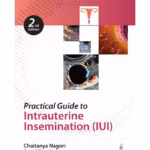 Practical Guide To Intrauterine Insemination (Iui)