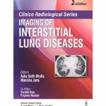 Clinico Radiological Series Imaging Of Interstitial Lung Diseases