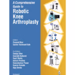 A Comprehensive Guide To Robotic Knee Arthroplasty