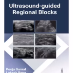 Ultrasound-Guided Regional Blocks