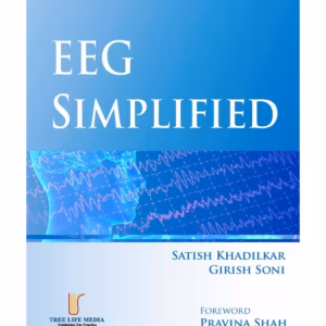 EEG Simplified -1st Edition