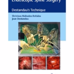 Endoscopic Spine Surgery 1st Edition
