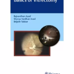 Basics of Vitrectomy 1st Edition