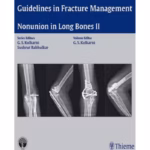 Nonunion in Long Bones-Part II