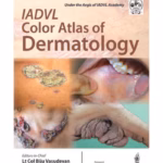 Iadvl Color Atlas Of Dermatology