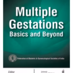 Multiple Gestations:Basics And Beyond
