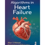 Algorithms In Heart Failure
