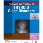 Principles And Practices Of Thyroid Gland Disorders