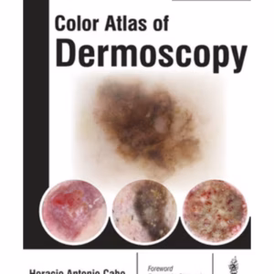 Color Atlas Of Dermoscopy