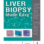 Liver Biopsy Made Easy