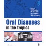 Oral Diseases In The Tropics