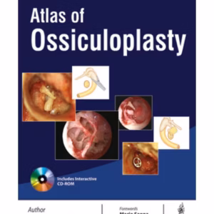 Atlas Of Ossiculoplasty