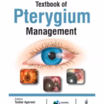 Textbook Of Pterygium Management With Dvd-Rom