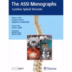 The ASSI Monographs-Lumbar Spinal Stenosis