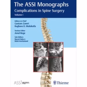 The ASSI Monographs-Complications in Spine Surgery
