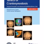 Tenets of Craniosynostosis