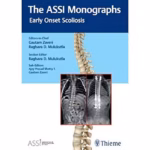 The ASSI Monographs—Early Onset Scoliosis