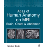 Atlas Of Human Anatomy On Mri:Brain, Chest & Abdomen