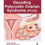 Decoding Polycystic Ovarian Syndrome (Pcos)