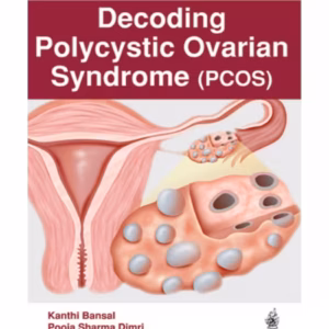 Decoding Polycystic Ovarian Syndrome (Pcos)