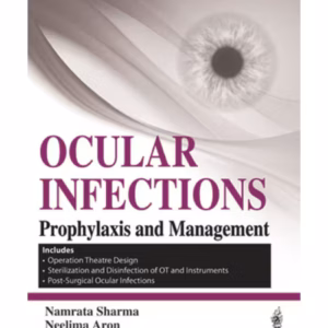Ocular Infections Prophylaxis And Management