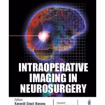 Intraoperative Imaging In Neurosurgery
